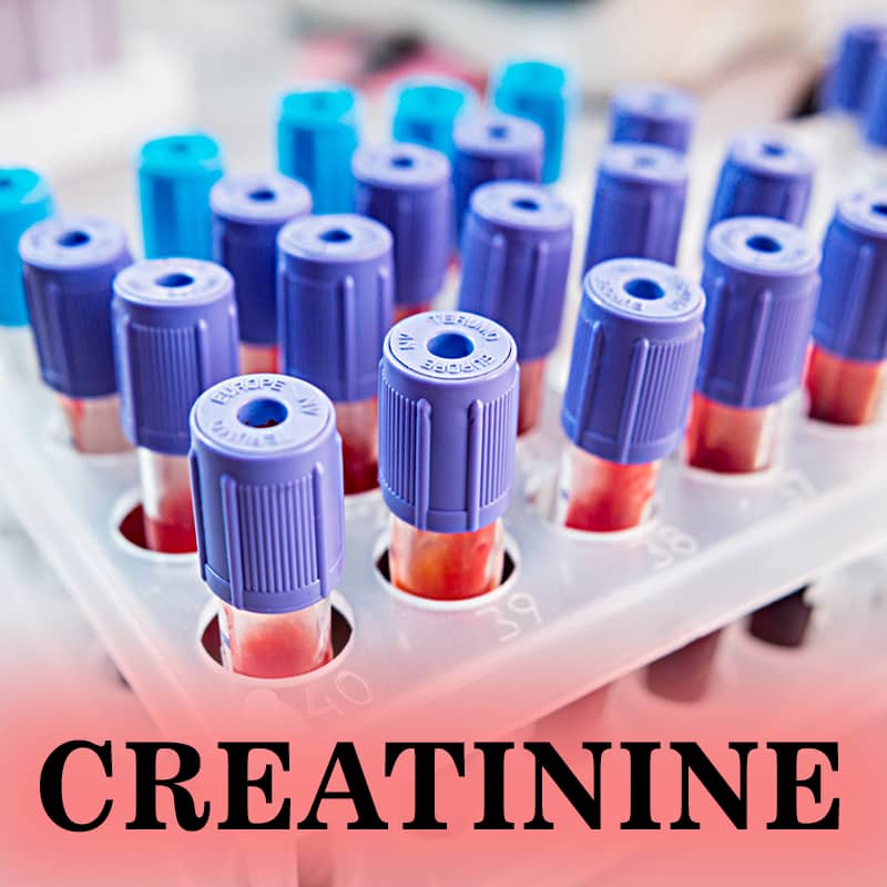 Ayurvedic treatment for creatinine
